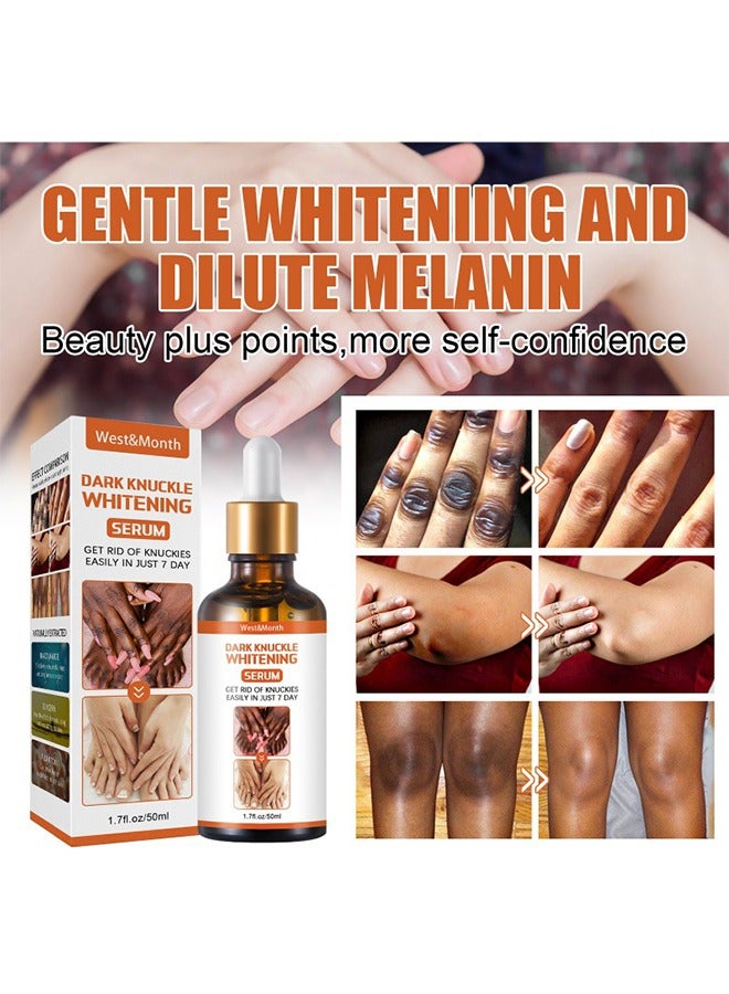 Dark Knuckle Whitening Serum-Restoring Hand Treatment, Moisturizing, Exfoliates and Reduces Unbalanced Pigmentation, for Removing Dark Knuckle Elbow, Brighter, Firmer Skin