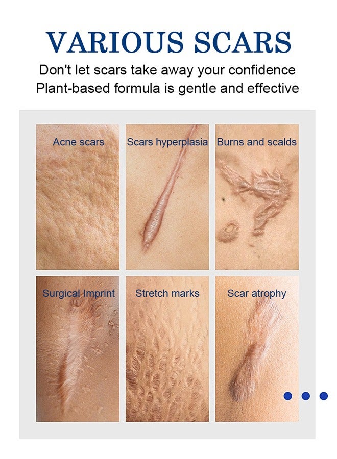 Scar Removal Cream-Skin Repairing Cream Fade Scars/Stretch Marks/Acne Treatment, Improve Scar Skin, Deeply Moisturizes Skin-30ml