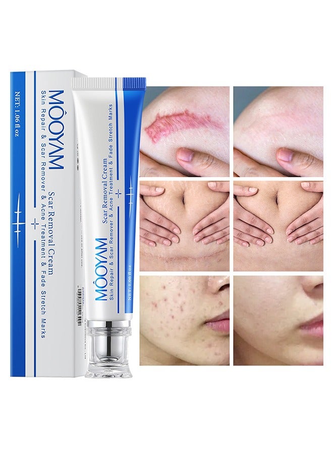 Scar Removal Cream-Skin Repairing Cream Fade Scars/Stretch Marks/Acne Treatment, Improve Scar Skin, Deeply Moisturizes Skin-30ml