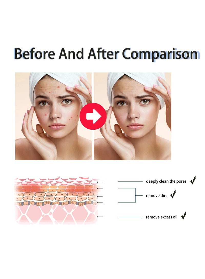 West&Month Salicylic Acid Acne Clearing Essence, Fading Acne Marks, Repairing Acne Skin, Mild Acne Clearing and Hydrating Essence 118ml