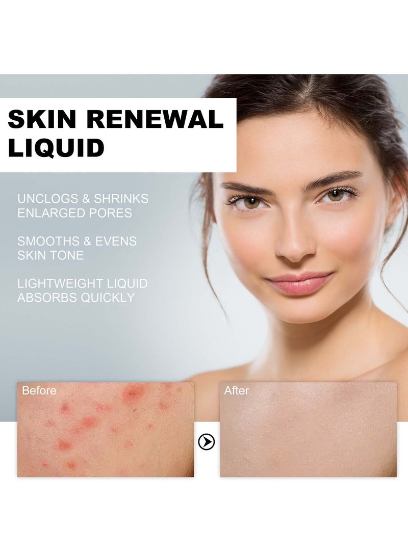 West&Month Salicylic Acid Acne Clearing Essence, Fading Acne Marks, Repairing Acne Skin, Mild Acne Clearing and Hydrating Essence 118ml