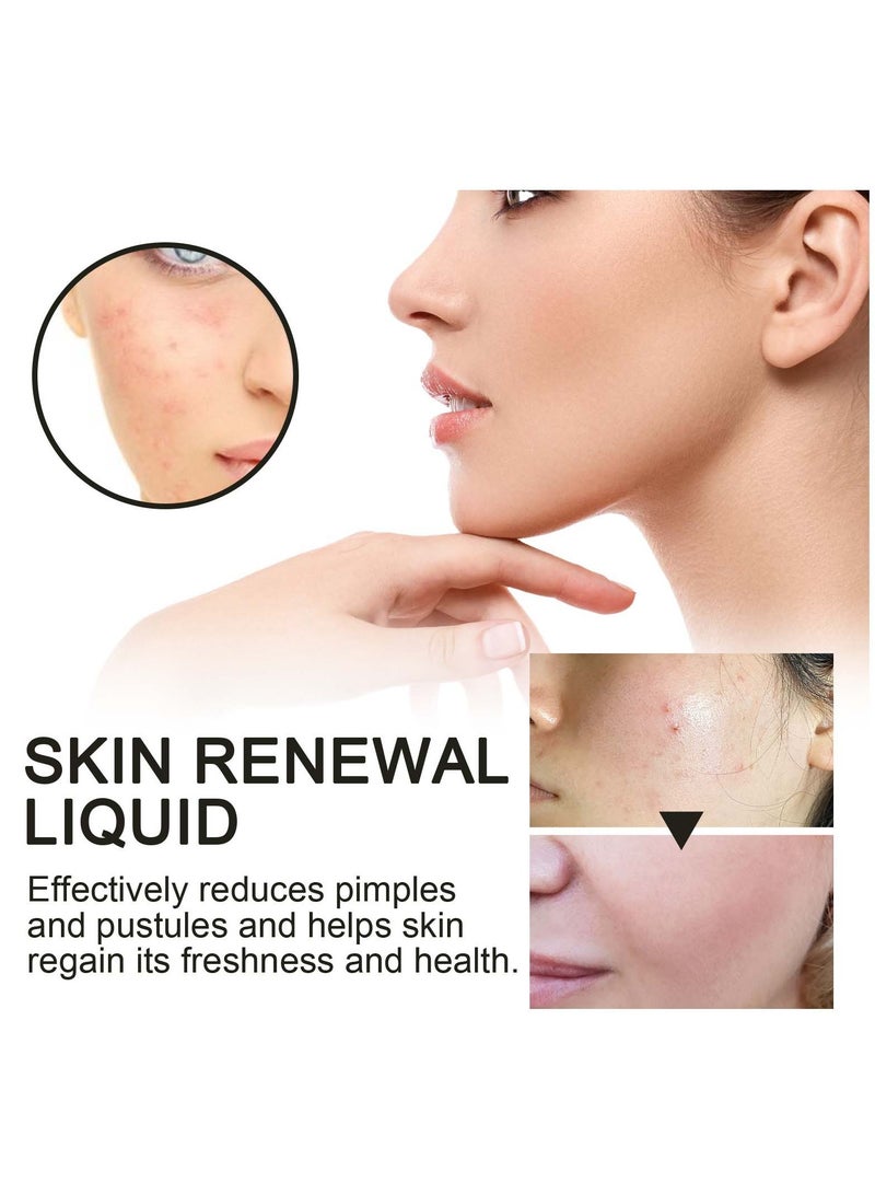 West&Month Salicylic Acid Acne Clearing Essence, Fading Acne Marks, Repairing Acne Skin, Mild Acne Clearing and Hydrating Essence 118ml