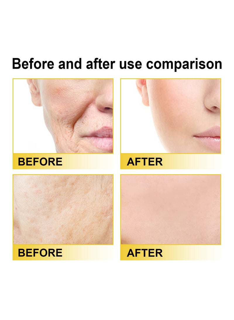 West&Month Vitamin C facial essence fades fine lines, tightens, smoothes, moisturizes and anti-aging essence 30ml