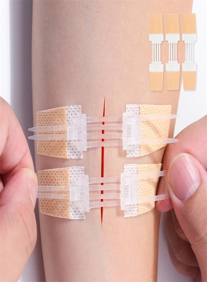 3 Pcs Zip Stitch Wound Closure Device Emergency Zipstitch Laceration Kit Bandages with Steri Strips Painless Laceration Repair Without Stitches Wound Care First Aid
