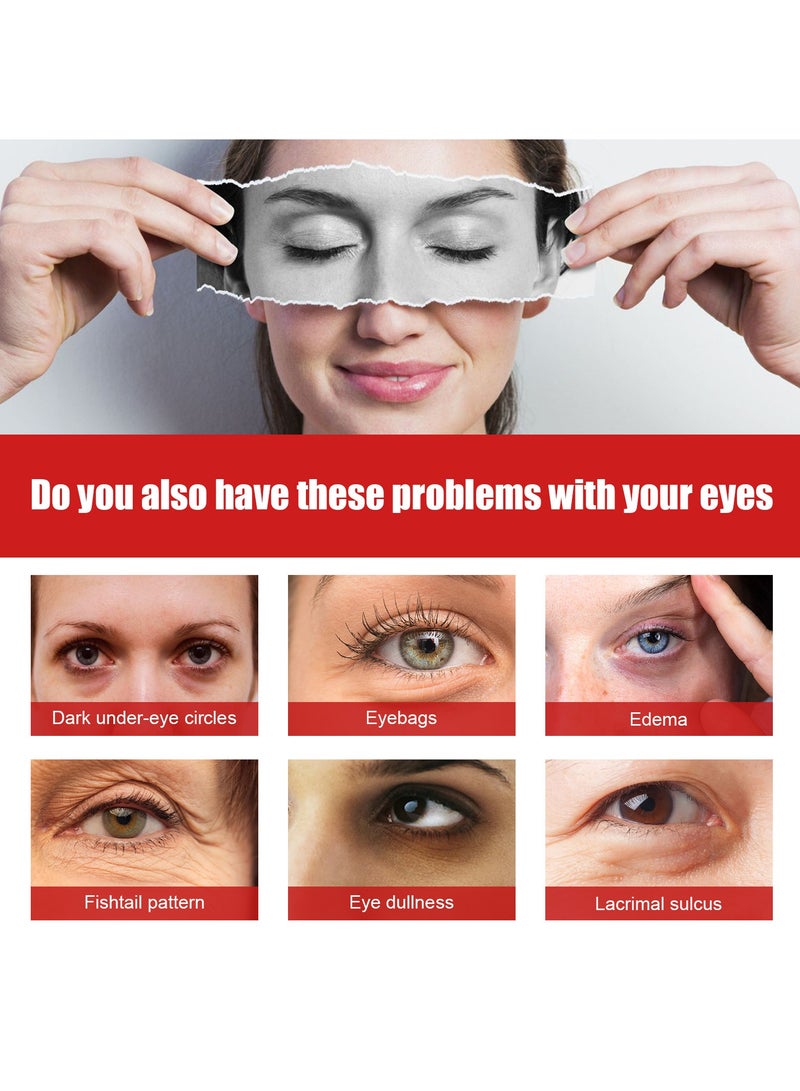 Jaysuing Lifts, Firms, Diminishes Fine Lines and Dark Circles at the Corner of the Eyes, Anti-Wrinkles and Anti-Aging