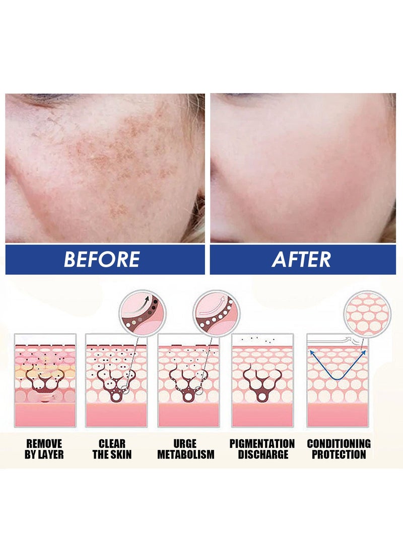 Jaysuing Lightens Spots, Improves Dull Skin Tone, Brightens Skin Facial Essence 30ml