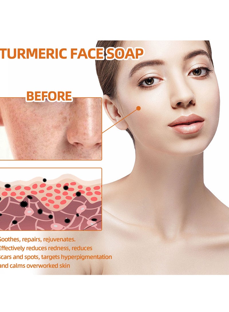 West&Month Turmeric Cleansing Soap Facial Repair gently cleanses spots and reduces fine lines