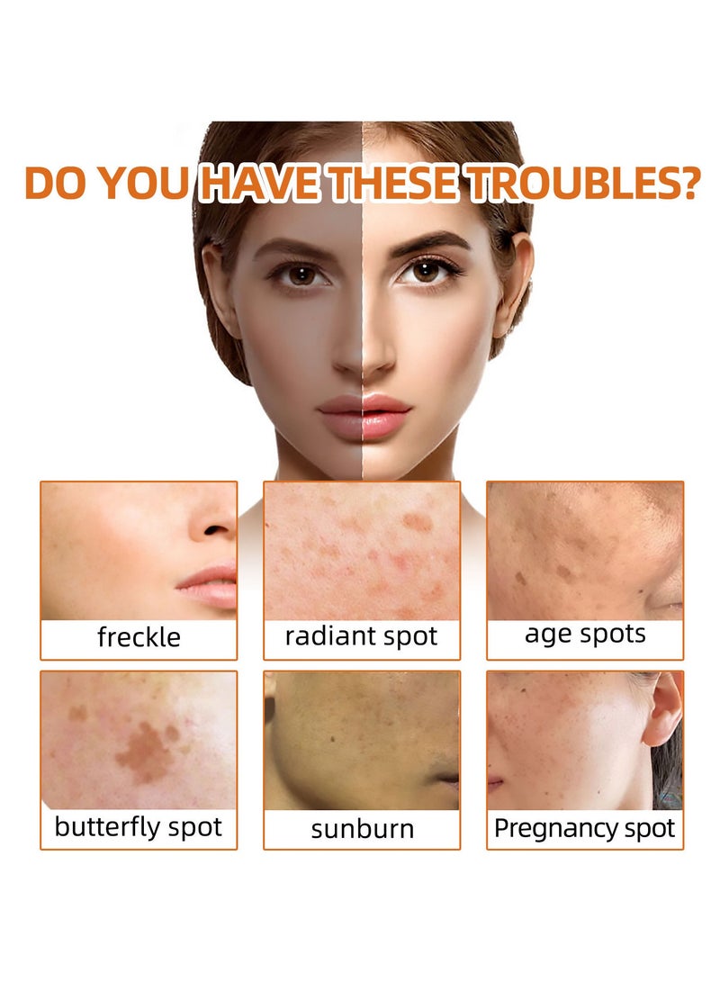 West&Month Turmeric Cleansing Soap Facial Repair gently cleanses spots and reduces fine lines