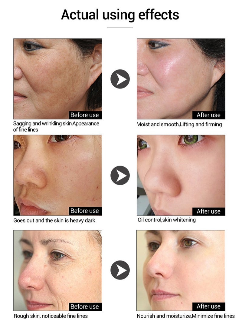 LANBENA Hyaluronic Acid Serum Vitamin C Serum Six Peptides Serum  Gold Anti aging