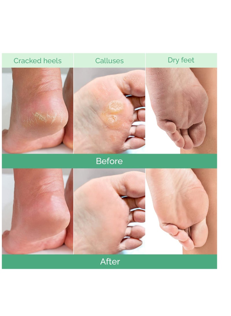 PLANTIFIQUE Foot Peeling Mask (2 Pairs) - Peeling Foot Mask Dermatologically Tested Repairs Heels & Removes Dry Dead Skin for Baby Soft Feet - Exfoliating Foot Peel Mask for Dry Cracked Feet (Peach)