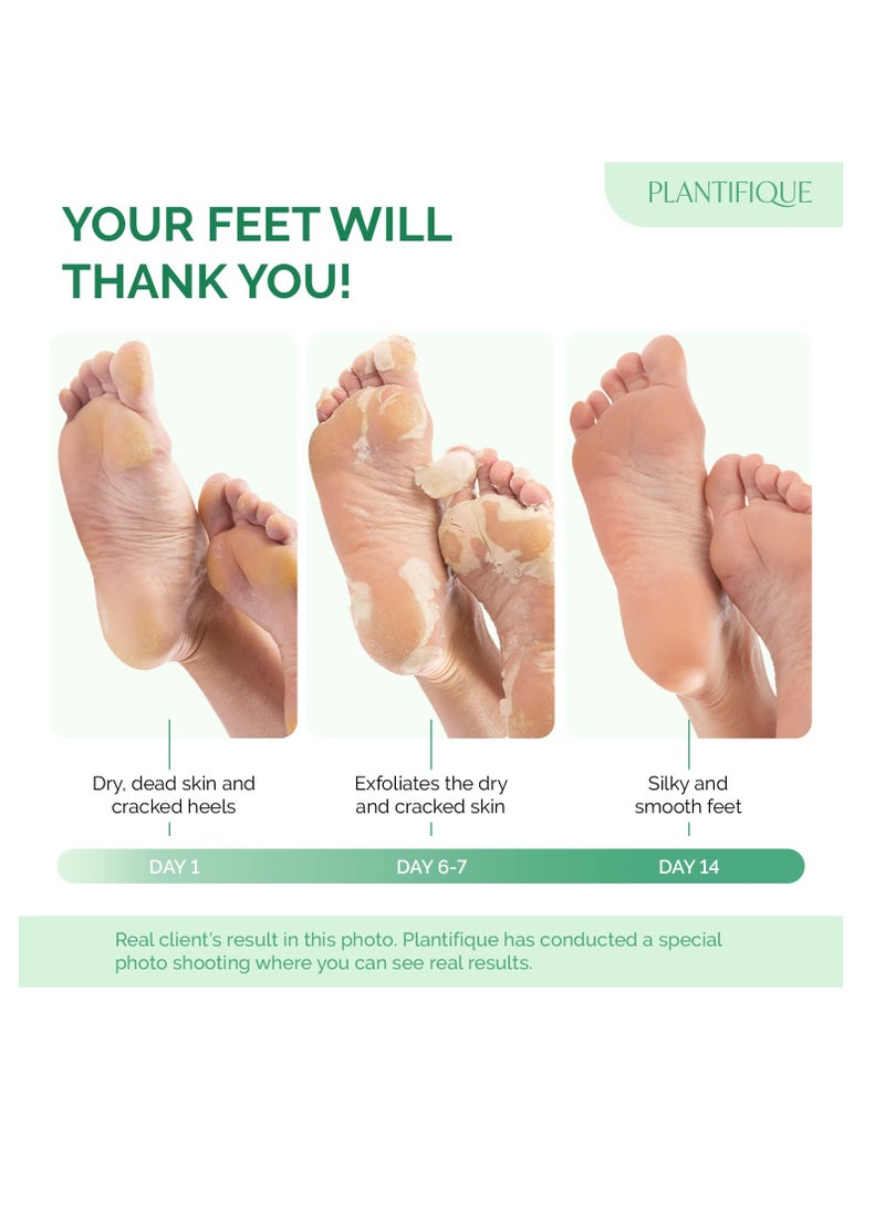 PLANTIFIQUE Foot Peeling Mask (2 Pairs) - Peeling Foot Mask Dermatologically Tested Repairs Heels & Removes Dry Dead Skin for Baby Soft Feet - Exfoliating Foot Peel Mask for Dry Cracked Feet (Peach)