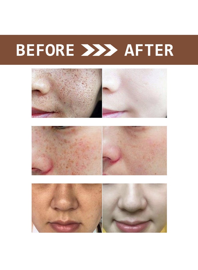 OUHOE Fading Facial Spots, Hydrating, Moisturizing and Whitening Cream 20g