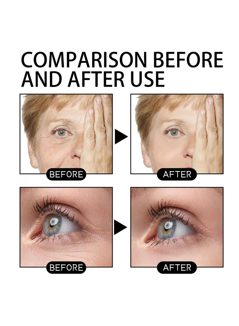 Jaysuing Fades Fine Lines, Folds, Tightens Skin, Moisturizes And anti-Wrinkle Cream 50ml