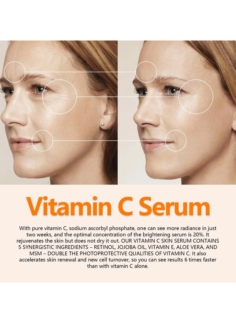 OUHOE fade fine lines, folds, tighten facial skin, anti-aging essence 30ml