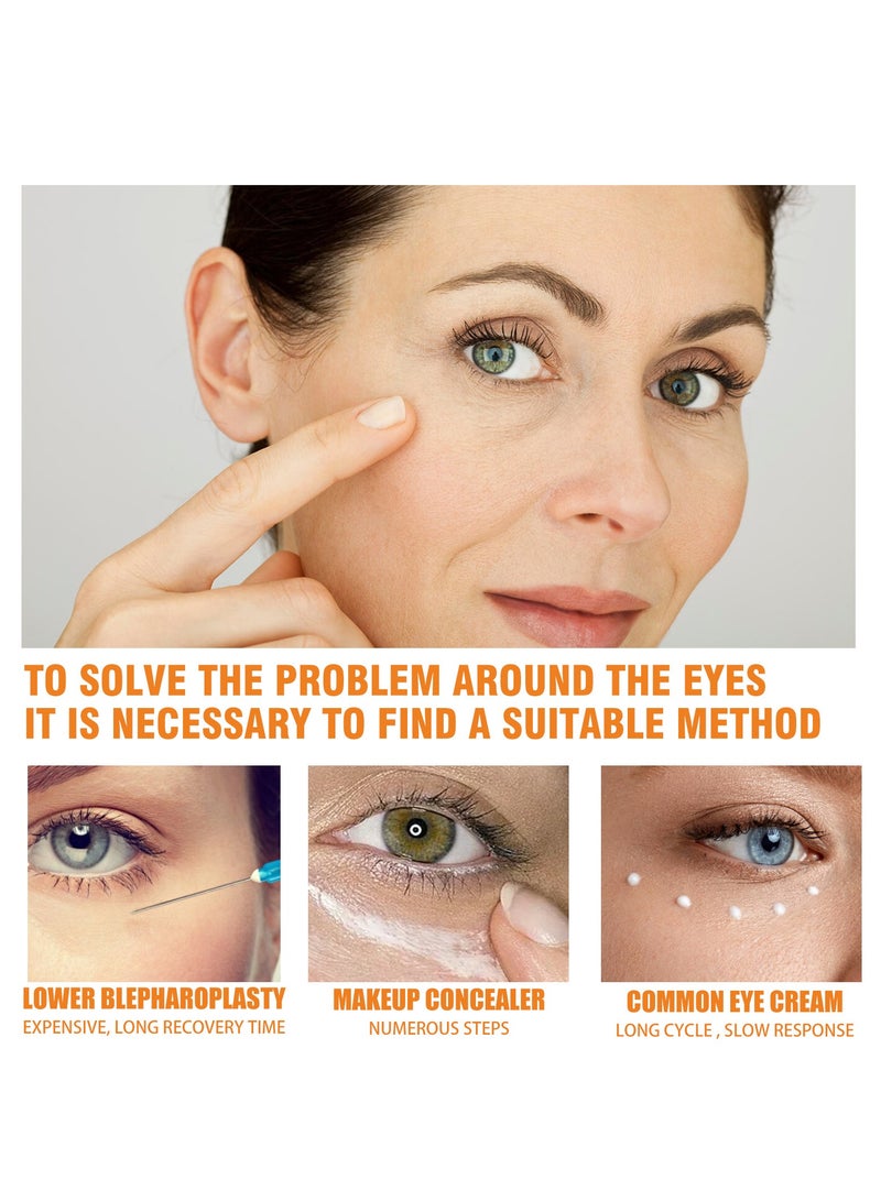 OUHOE improve fine lines around the eyes, reduce eye bags and dark circles, moisturizing eye cream 30g