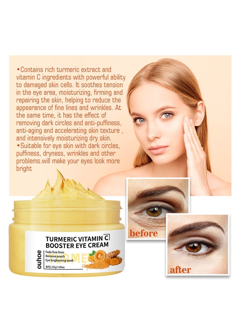 OUHOE improve fine lines around the eyes, reduce eye bags and dark circles, moisturizing eye cream 30g