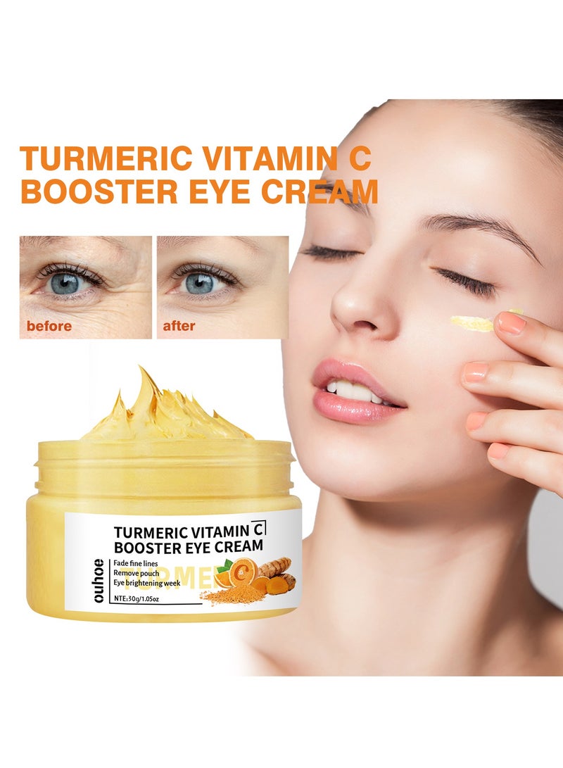 OUHOE improve fine lines around the eyes, reduce eye bags and dark circles, moisturizing eye cream 30g