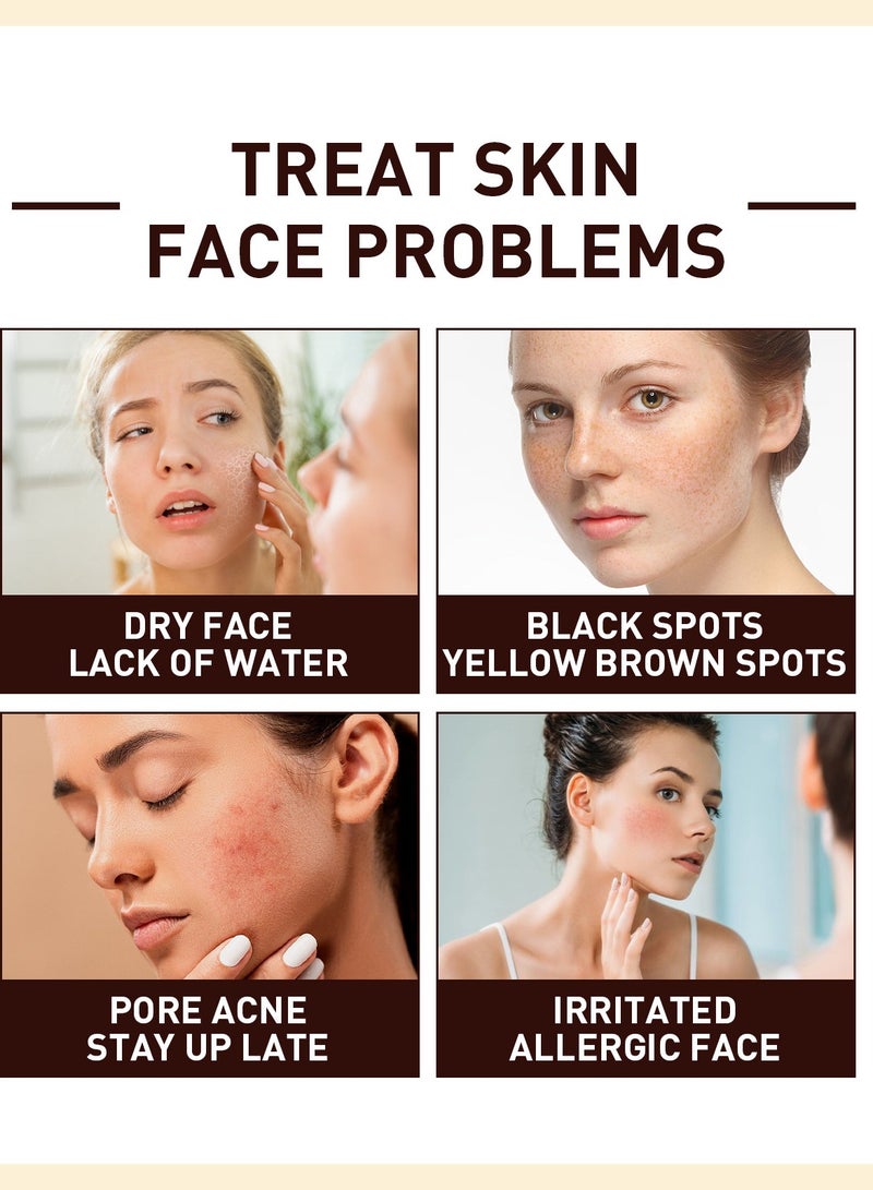 OUHOE Hydrating, Nourishing, Skin Barrier Repair, Fading Dark Spots, Fine Lines, Firming and Whitening 30ml