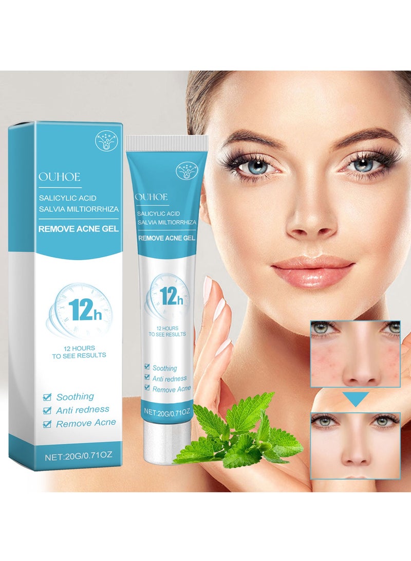 OUHOE Repair Facial Closed Acne, Fade Acne Marks and Blackheads 20g