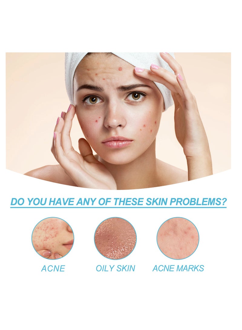 OUHOE Repair Facial Closed Acne, Fade Acne Marks and Blackheads 20g