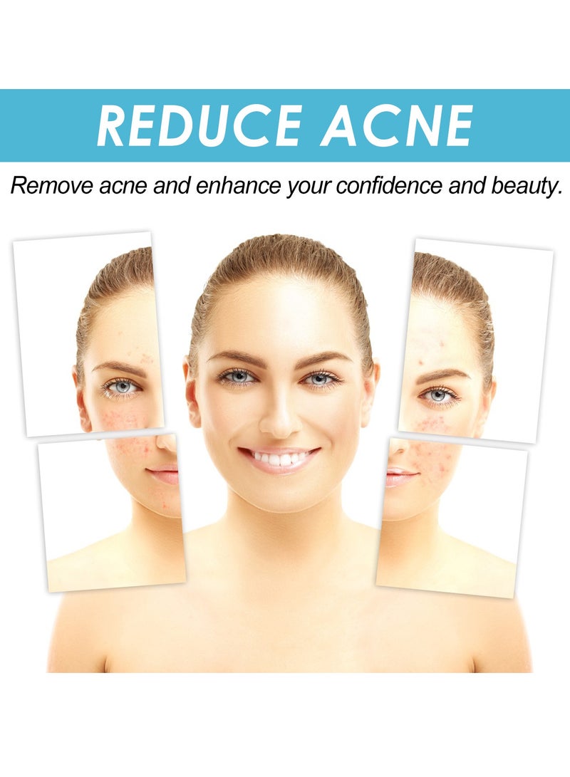 OUHOE Repair Facial Closed Acne, Fade Acne Marks and Blackheads 20g