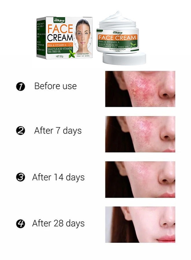 Face cream BHA & VITAMIN A ,Acne Treatment Face Cream, Acne Spot Treatment for Face & Acne Dots, Natural Cystic Acne Treatment, For All Skin Types, Premium Acne Scar Cream & Pimple Remover - 30g