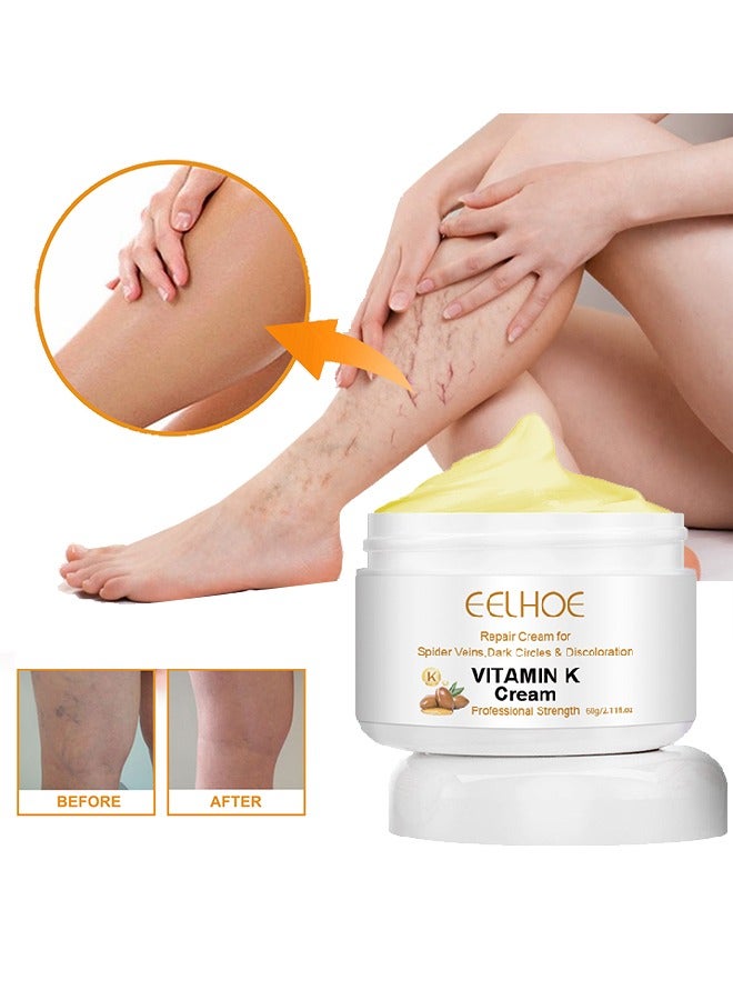 Vitamin K Cream, Varicose Veins Cream, Soothing Leg Cream, Varicose and Spider Veins Treatment Cream, Improve Blood Circulation, Fast Relieve Swelling Pain 60g