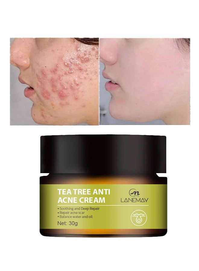 Natural- Tea Tree Anti Acne Cream,Soothing And Deep Repair, Repair Acne Scar Balance, Natural Cystic Acne Treatment, For All Skin Types 30g