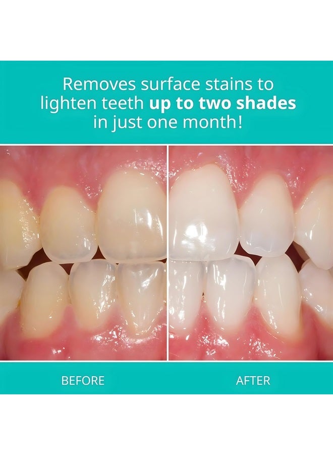 Whitening Toothpaste for Sensitive Teeth (12 Pack) - Oral Care, Mint Flavor, Gluten Free - 5167-12