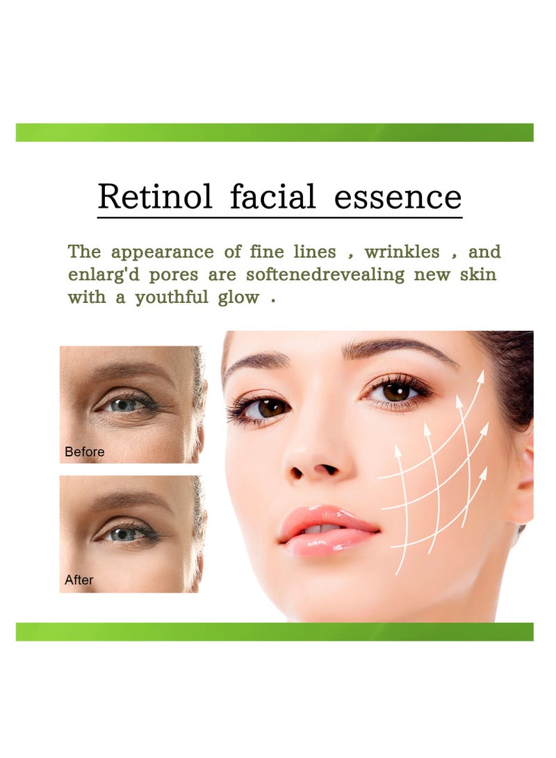 OUHOE facial anti-wrinkle firming and brightening skin, smoothing and repairing fine lines around the eyes and folds 10ml