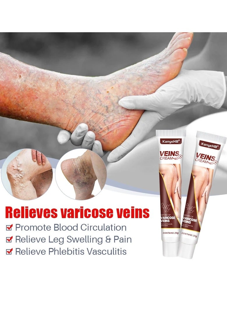 Varicose Veins Remove Cream, Blood Circulation Vein Care Leg Cream, Vasculitis Phlebitis Foot Care Ointment, Pain Relief Therapy Firming Vein Lotion For Treatment Of Varicose Veins