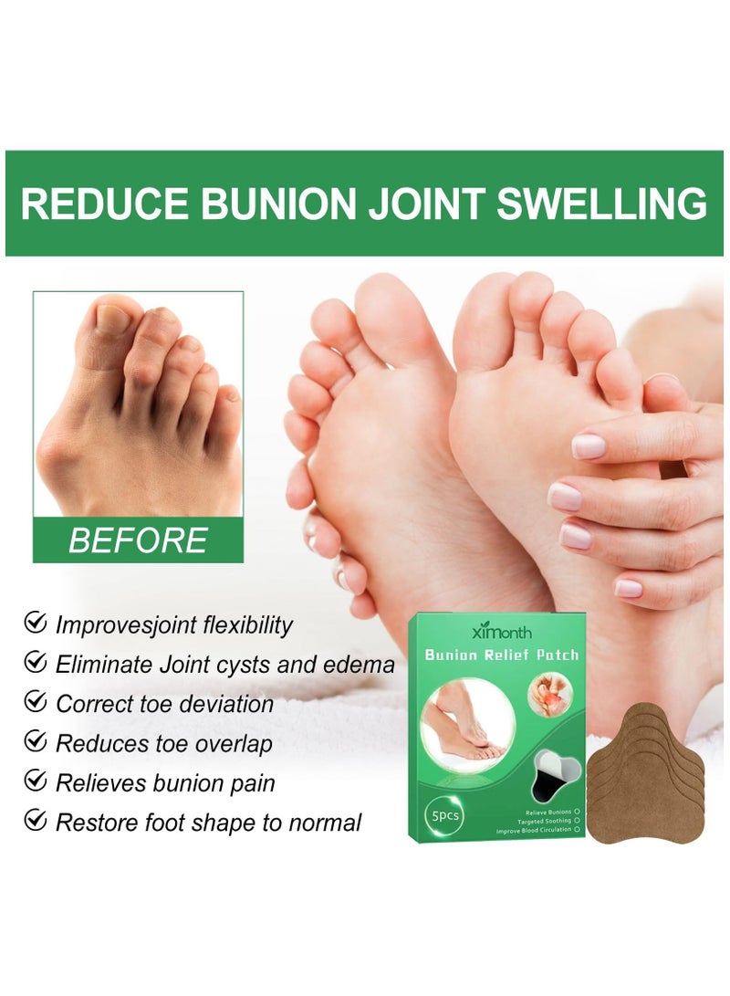 Feetin Bunion Relief Fit Patch, Strong Joints Anti Bunion Patch, Bunion Relief, Toe Spacers for Foot Pain Relief from Rubbing And Pressure, Green, 3 Box