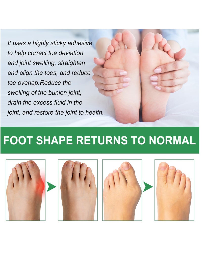 Feetin Bunion Relief Fit Patch, Strong Joints Anti Bunion Patch, Bunion Relief, Toe Spacers for Foot Pain Relief from Rubbing And Pressure, Green, 3 Box