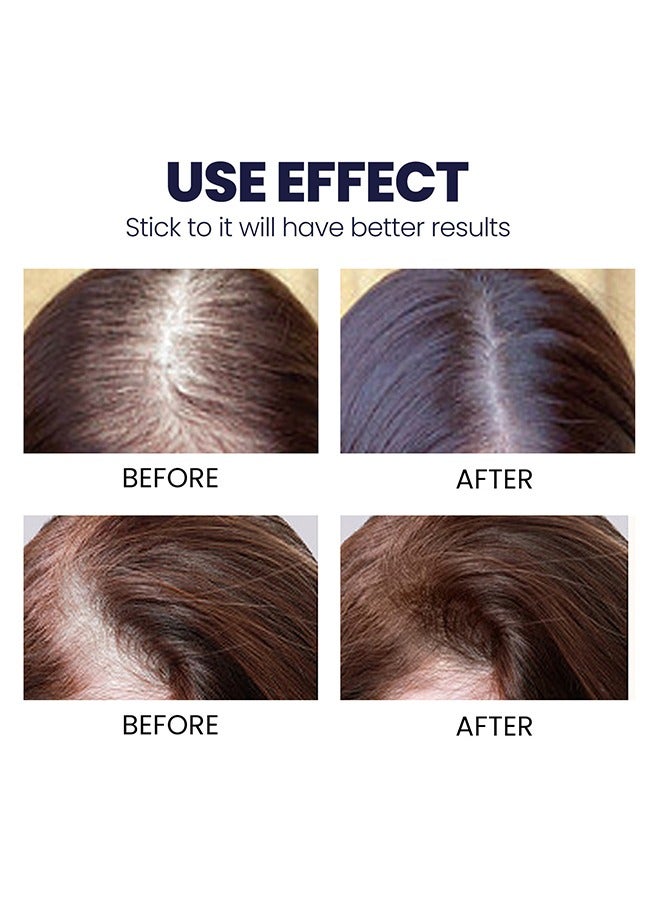 Hair Growth Spray, Hair Growth Serum Spray, Ultra Hair Growth Formula Serum Spray, Grow Thicker Hair In 8 Weeks