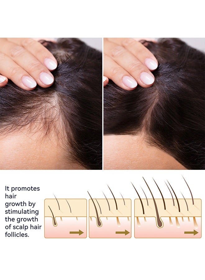 Hair Growth Spray, Hair Growth Serum Spray, Ultra Hair Growth Formula Serum Spray, Grow Thicker Hair In 8 Weeks