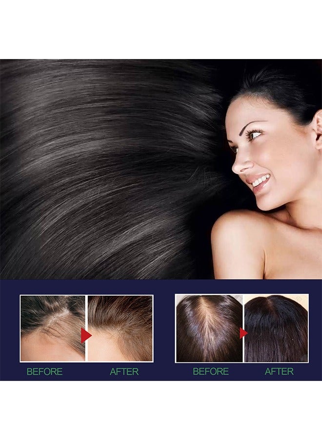 Hair Growth Spray, Hair Growth Serum Spray, Ultra Hair Growth Formula Serum Spray, Grow Thicker Hair In 8 Weeks