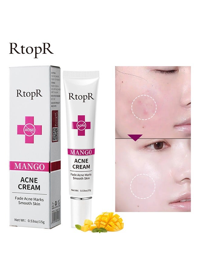Mango Acne Cream,Fade Acne Marks Smooth Skin 15grams