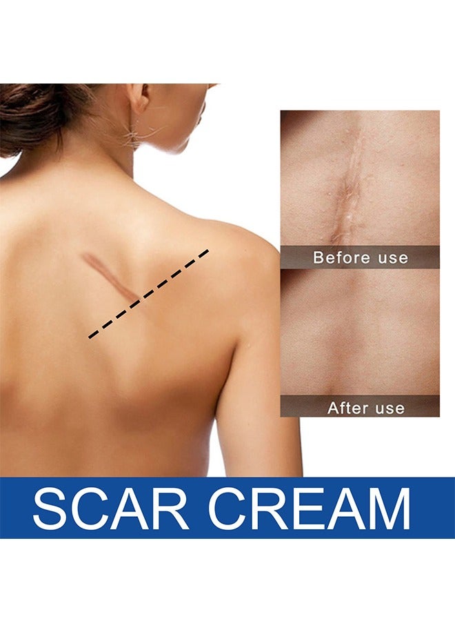 SCAR CREAM,New Gel Advanced Silicone Gel Of Scar Cream
