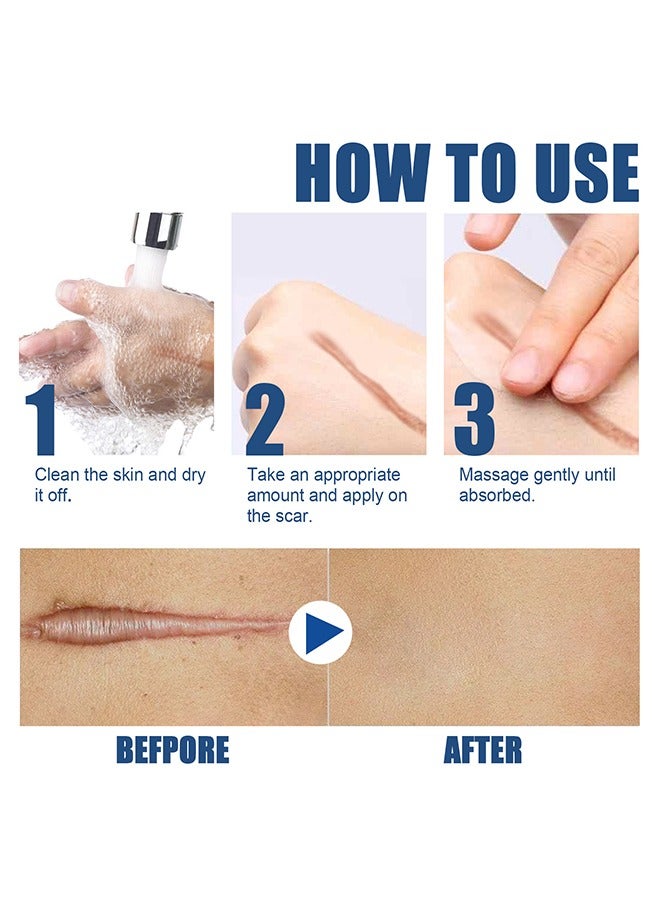 SCAR CREAM,New Gel Advanced Silicone Gel Of Scar Cream