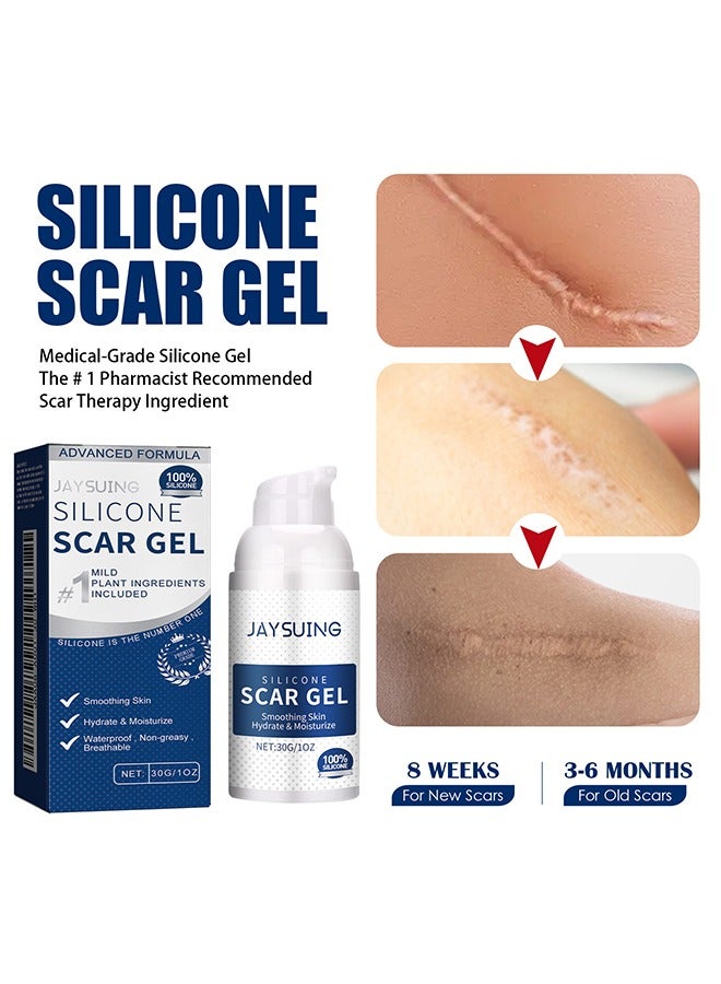 Silicone Scar Gel,30g Scar Cream Scar Removal,Scar Treatment, Scar Removal Cream for C-Section, Stretch Marks, Acne, Surgery, Effective for Both Old and New Scars