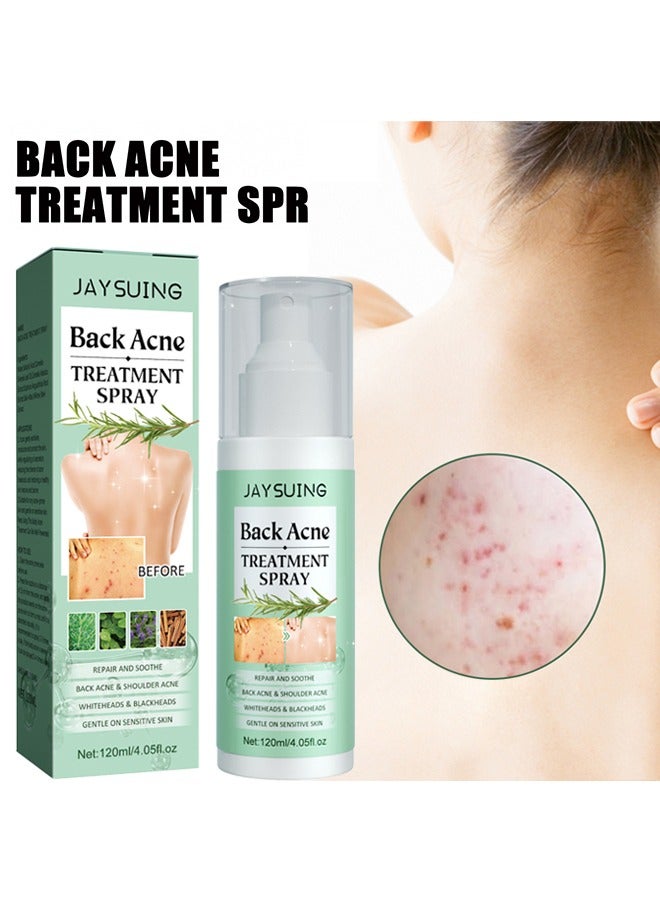 Back Acne Treatment Spray, 2% Salicylic Acid Spray, Body Acne Treatment with Herbal Formula, Body Acne Spray, Tea Tree Oil Spray, Acne Treatment For Teens, Back Acne 120ml
