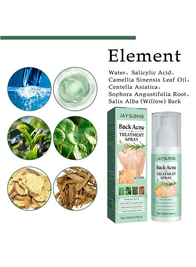 Back Acne Treatment Spray, 2% Salicylic Acid Spray, Body Acne Treatment with Herbal Formula, Body Acne Spray, Tea Tree Oil Spray, Acne Treatment For Teens, Back Acne 120ml