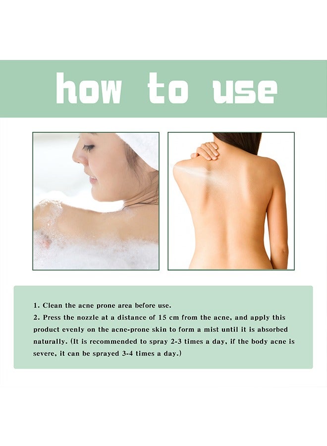 Back Acne Treatment Spray, 2% Salicylic Acid Spray, Body Acne Treatment with Herbal Formula, Body Acne Spray, Tea Tree Oil Spray, Acne Treatment For Teens, Back Acne 120ml