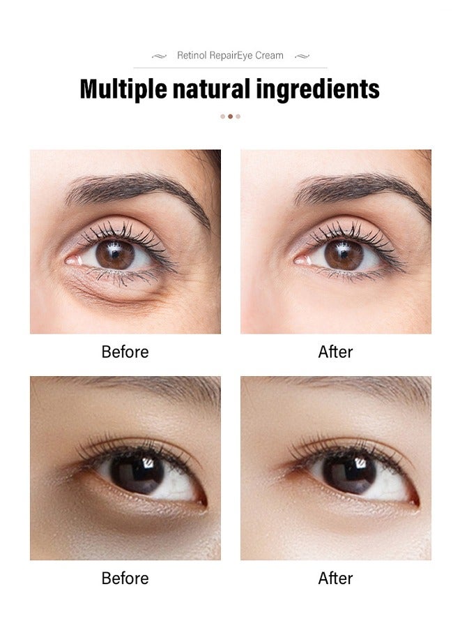 Retinol Repalr Eye Cream/Fade fine lines and dark circles in the eyes 30g