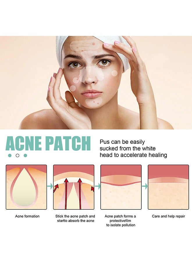 Pimple Patches Acne Patches, 5 Sizes 132 Patches Pimple Patches For Face, Chin Or Body, Acne Treatment with Tea Tree And Salicylic Acid, Hydrocolloid Bandages For Acne Skin