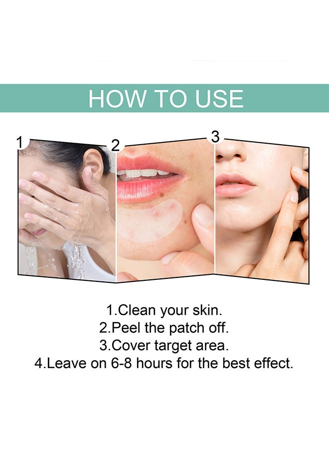 Pimple Patches Acne Patches, 5 Sizes 132 Patches Pimple Patches For Face, Chin Or Body, Acne Treatment with Tea Tree And Salicylic Acid, Hydrocolloid Bandages For Acne Skin