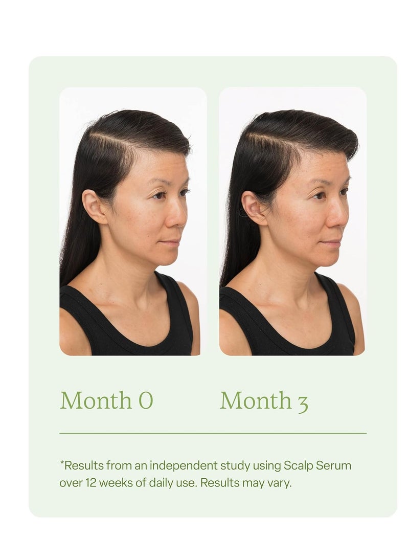 divi Scalp Serum for Thinning Hair, 30ml – Clinically Tested, Nourishing Formula with Amino Acids, Caffeine & Rosemary Oil – Promotes Healthy Scalp & Fuller-Looking Hair, Reduces Oil & Product Buildup