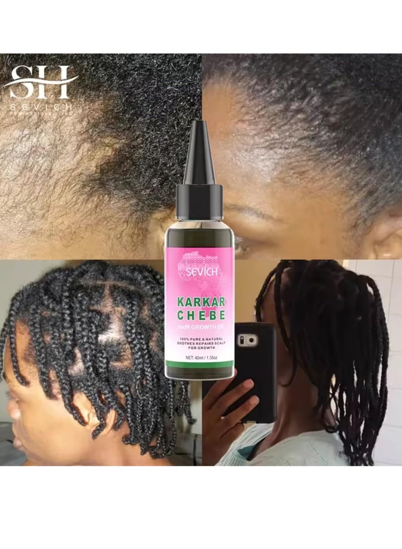 Karkar Chebe Hair Growth Oil 100% Pure and Natural Soothes Repairs Scalp for Hair Growth with Karkar and Chebe Rosemary and Castor Seed Oil Moisturize Hydrate Prevent Hair Breakage Chebe oil 40ml