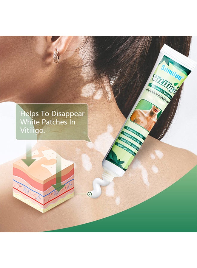 Vitiligo Treatment Ointment, Reduces White Spots On Skin, Pigmentation Regulating, Improve Skin Pigmentation, Reduces White Spots On Skin And Vitiligo Care Cream For Skin Cares, 20G