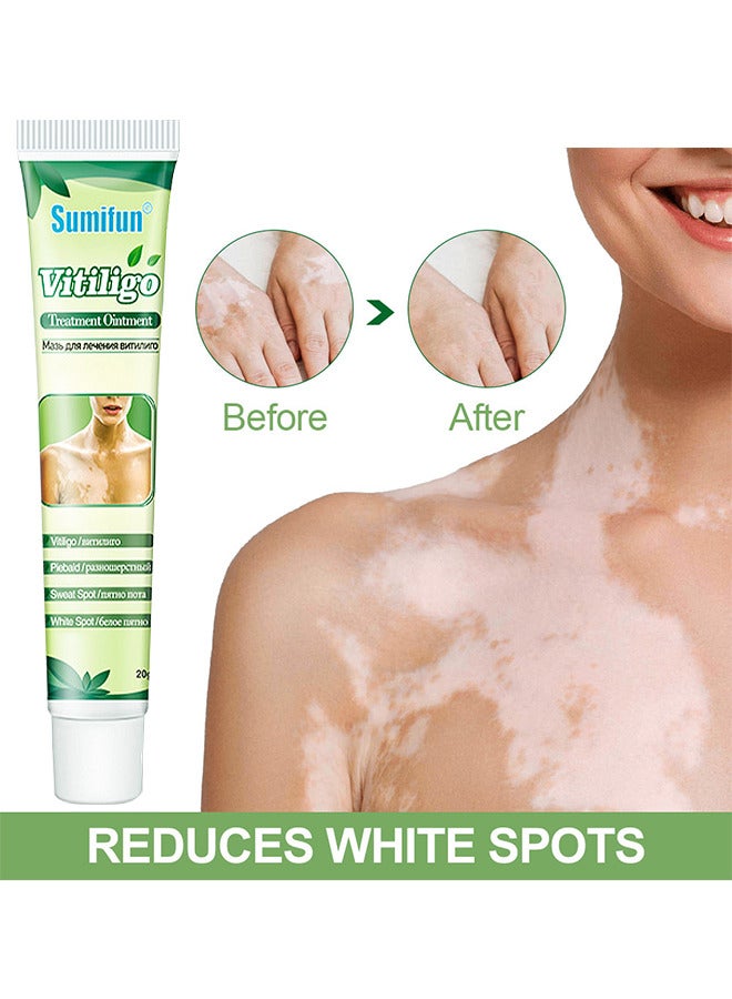 Vitiligo Treatment Ointment, Reduces White Spots On Skin, Pigmentation Regulating, Improve Skin Pigmentation, Reduces White Spots On Skin And Vitiligo Care Cream For Skin Cares, 20G